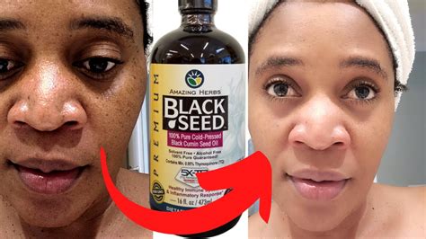 Black Seed Oil also happens to inhibit allergic reactions. . Can i put black seed oil in my eyes